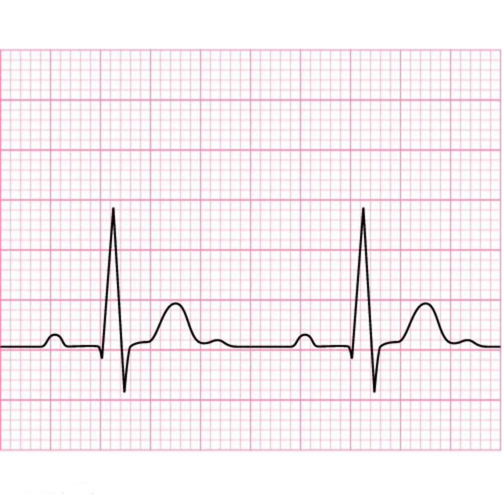 Paper Ecg 100 150