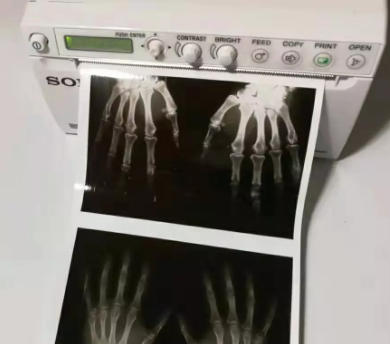 Carbonless Forms Printing