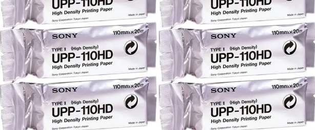 Sony UPP 110S Print Speed Performance